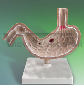 Stomach Model