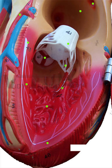 Heart: Left Ventricle