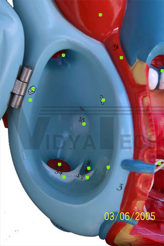 Heart: Right Atrium