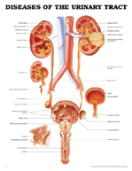 Diseases-of-the-Urinary Chart