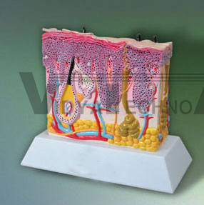 Psoriasis Skin Model