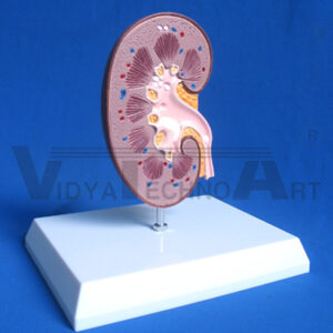 Stomach Anatomical Model Gastric Ulcer