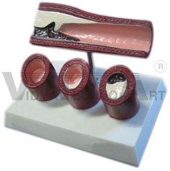 Bronchial Anatomical Model Set of 4