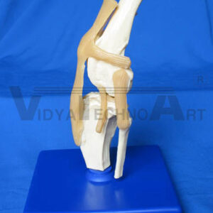 Lung Anatomical Model Set Pathology