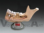 Disorders Of The Teeth And Jaw Anatomical Chart | Dental Charts