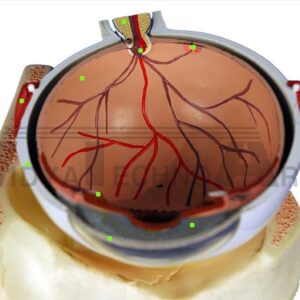 Eye: Optic Nerve