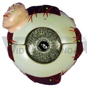 Eye Muscles