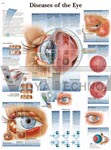 Diseases Of The Eye - Anatomical Chart | Eye Charts