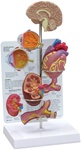Hypertension Model - Mini Brain, Eye, Heart, Kidney And Artery Models (Patient Education Card Included) | Heart Models