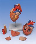 Heart Anatomy With Esophagus And Trachea, 2 Times Life Size, 5 Part Model | Heart Models