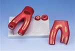 Arteriosclerosis Artery Model, With Cross Section Of Artery, 2 Part Model | Heart Models