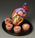 Heart Conditions Model | Heart Models