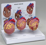 Mini Heart Set Models | Heart Models
