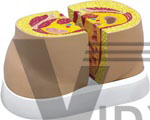 Human Obesity Model - Pear-Shaped And Apple-Shaped Cross-Sections | Male Models