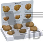 Human Male Prostate Anatomy Model With Patient Education Card | Male Models