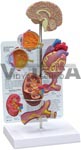 Hypertension Model - Mini Brain, Eye, Heart, Kidney And Artery Models (Patient Education Card Included) | Urinary Models