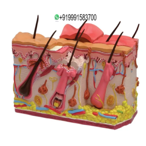 Skin Burn Model